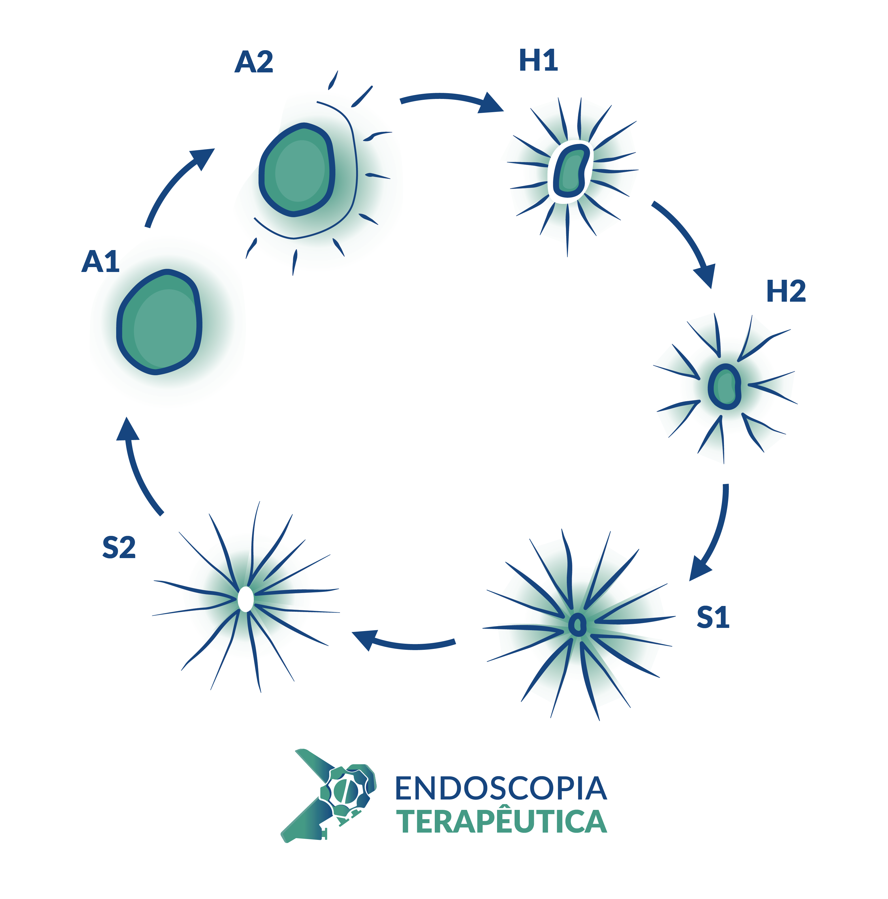 Classificação de Sakita • Endoscopy News